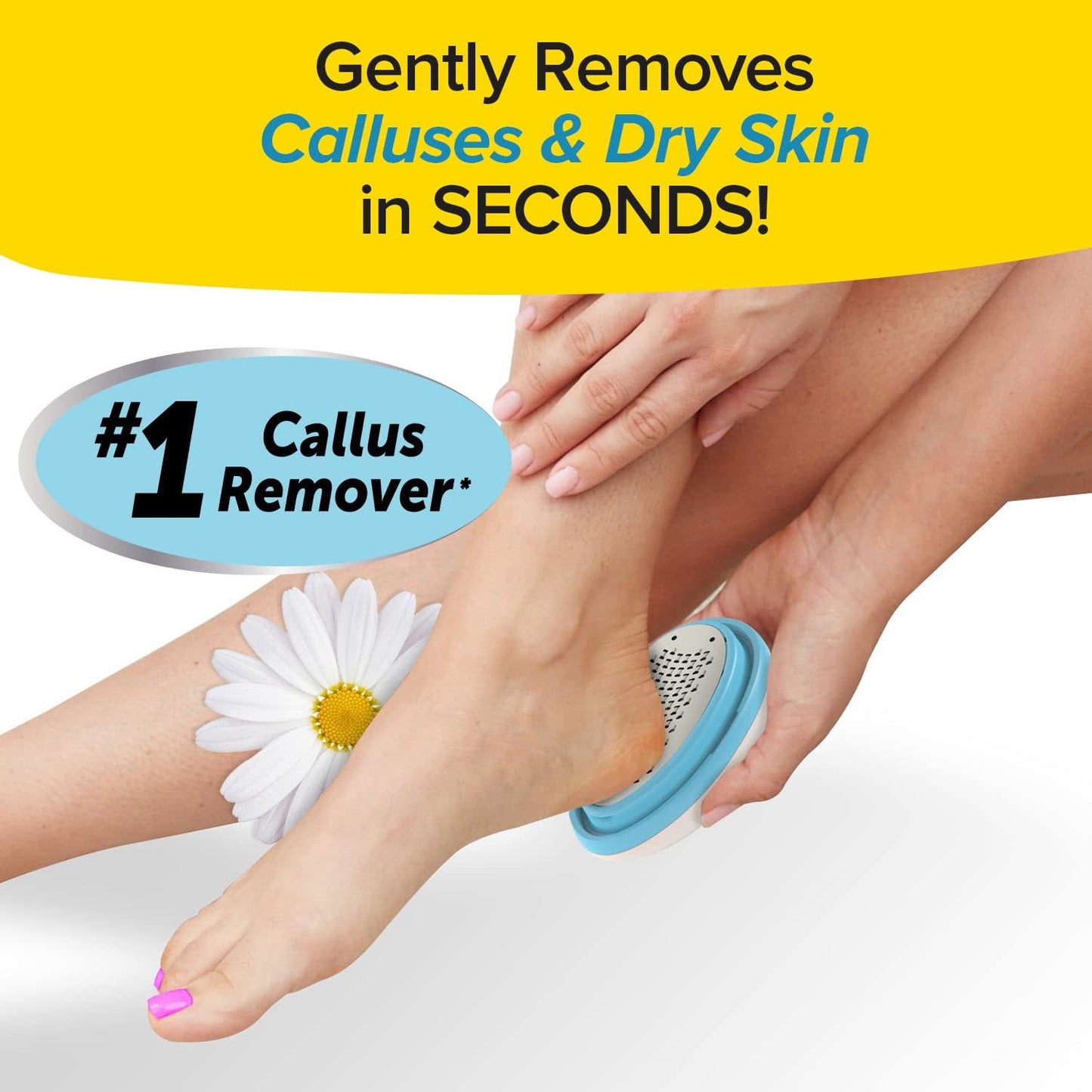 PedEgg Classic Callus Remover, As Seen On TV, New Look, Safely and Painlessly Remove Tough Calluses & Dry Skin to Reveal Smooth Soft Feet, 135 Precision Micro-Blades, Traps Shavings Mess-Free