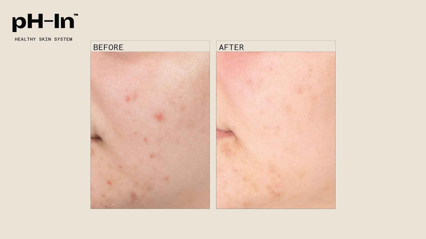 pH-In 3 Step Healthy Skin System