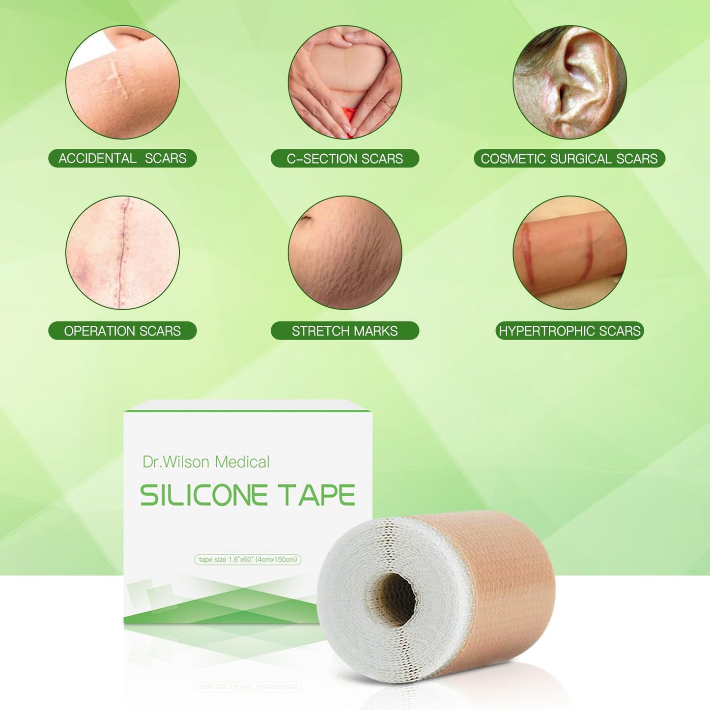 Medical Grade Soft Silicone Gel Tape (1.6” x 60”) for Scar Removal Sheets Scar Tape Painless Easy Removal For Surgery Recovery Breast Neck Nose (1.6” x 60” Roll)