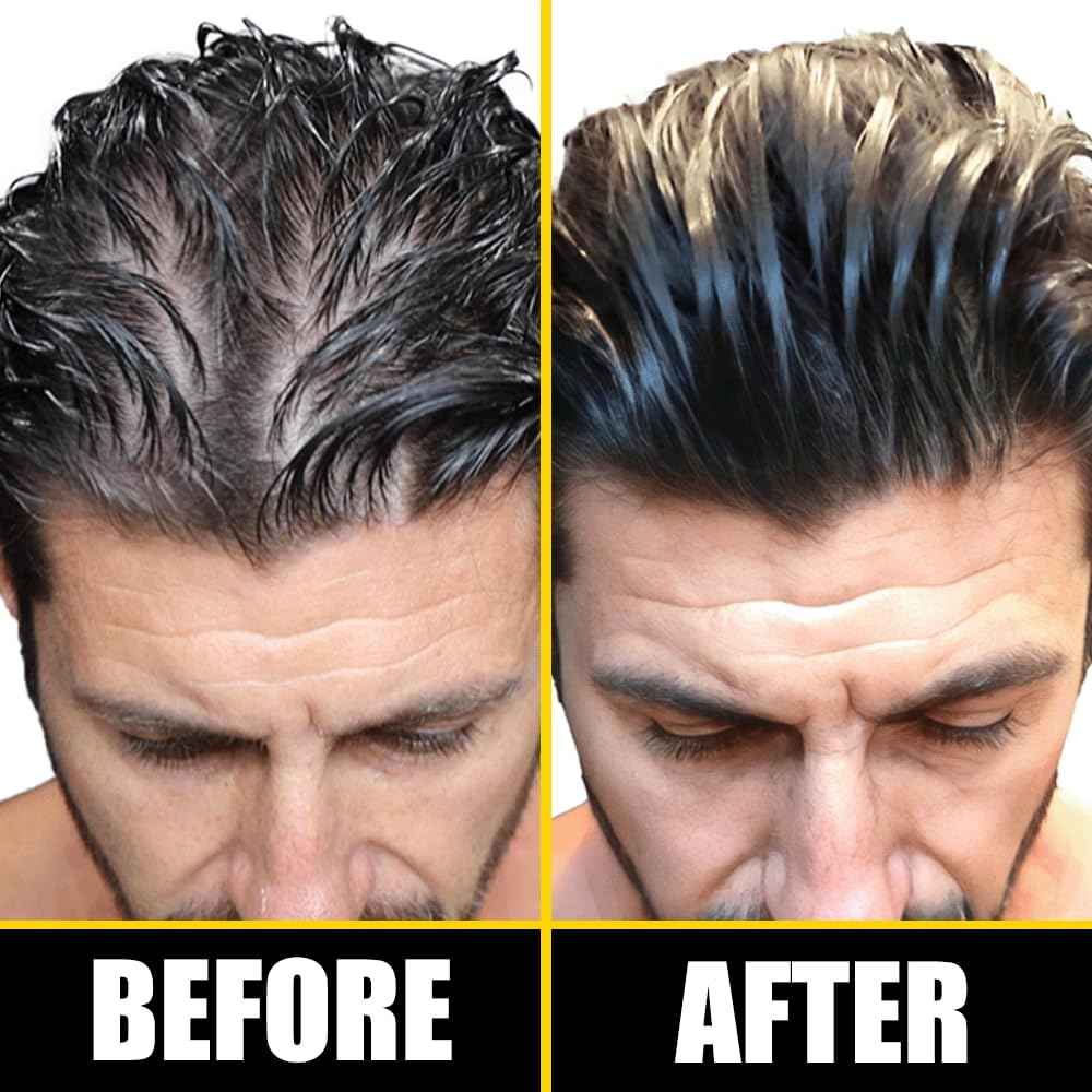 Pete & Pedro BOOST Hair & Beard Strengthening & Growth Natural Scalp Health Serum Oil For Men & Women - With Rosemary, Biotin & 20 plus Essential Oils | Shark Tank Featured, 2 oz.