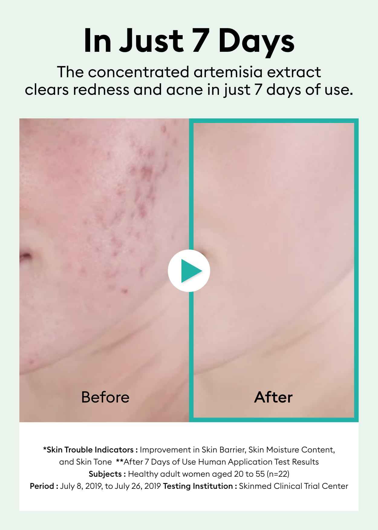 MISSHA Artemisia Calming Ampoule 1.69 Fl oz / 50ml - Face Serum for Sensitive Skin, Korean Skin Care with Double-Fermented Mugwort Extract, Soothes Redness, Acne & Irritation