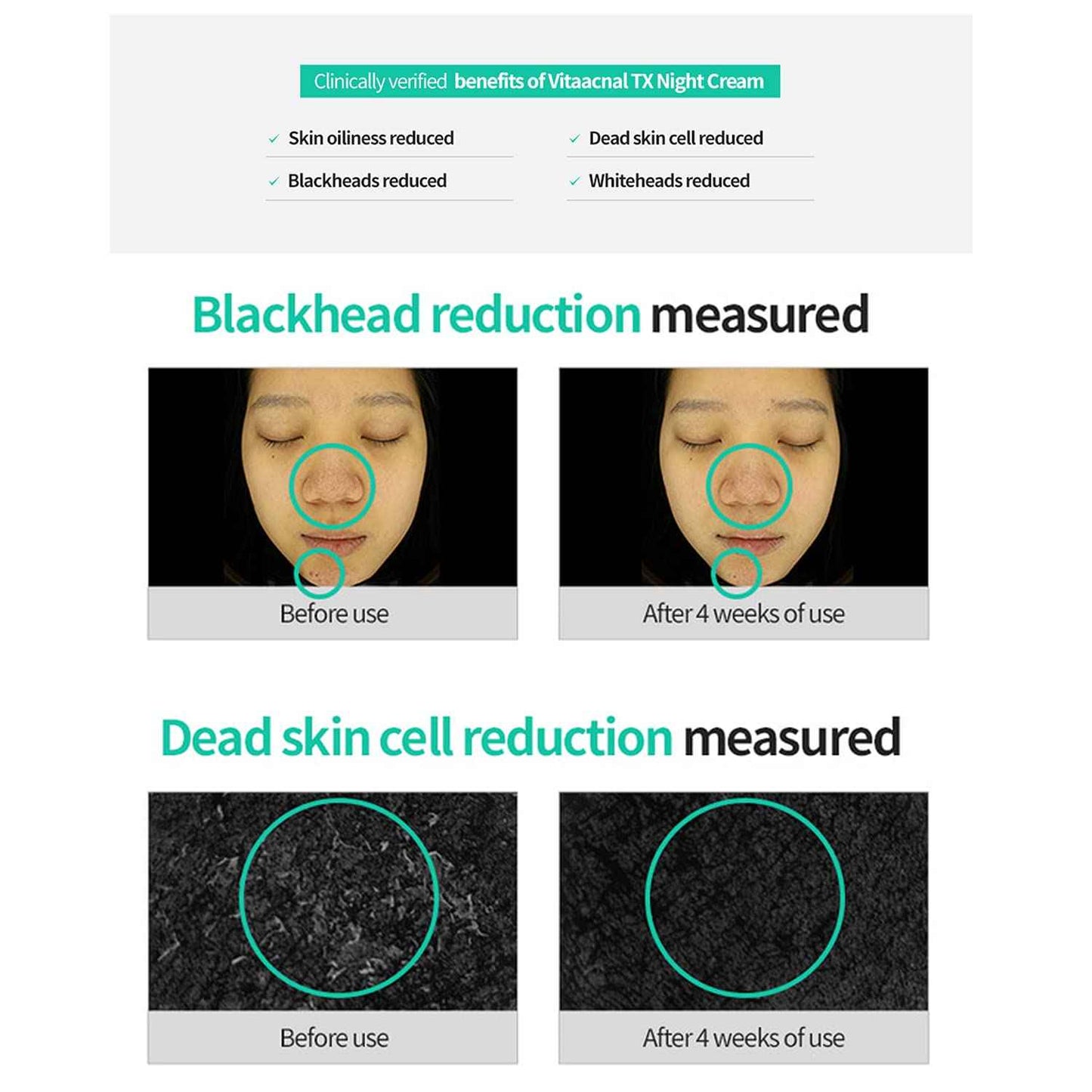 Dr. Different VITAACNAL TX Night Cream for Face - Soothing & Nourishing Retinal Sebum Control Night Cream For Acne-Prone Skin - Blackheads Care Oil-Free Treatment Removes Dead Skin Cells 0.7oz.