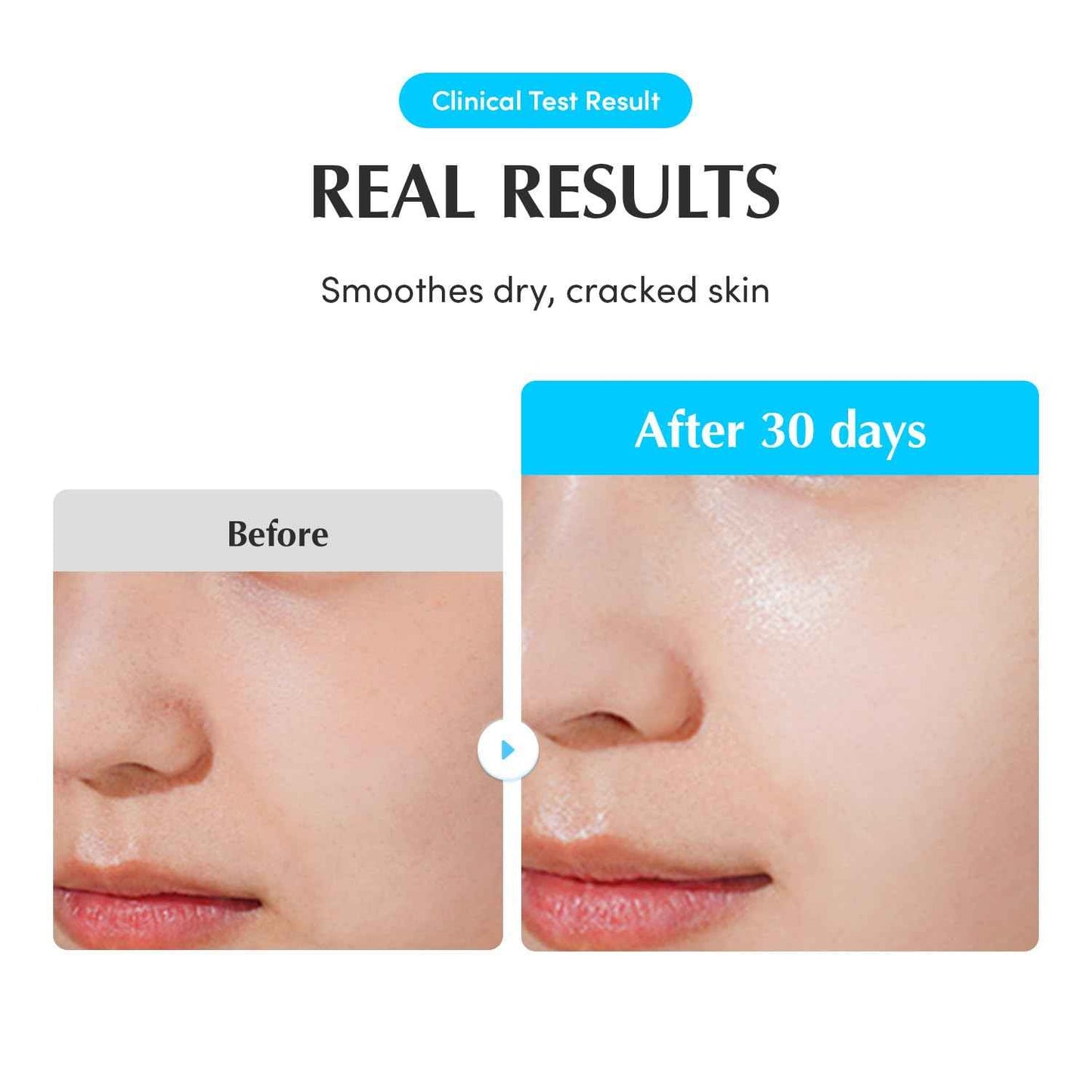 EQQUALBERRY Swimming Pool Ampoule - Hyaluronic Acid Serum for Glass Skin | Deep Hydration and Soothing with CICA Extracts | Korean Skin Care Serum, 1.69 Fl. Oz. 50ml