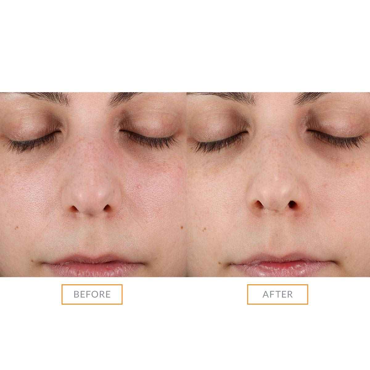 Clarisonic Sonic Face Exfoliator Cleansing Brush Head | Gentle Exfoliating Brush to Brighten Skin | Suitable for Sensitive Skin