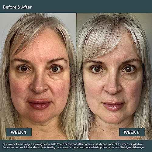 No7 Future Renew Damage Reversal Anti Aging Serum for Face - Face Serum for Women with Peptides to Support Skin Repair - Helps Reduce Fine Lines, Wrinkles, Dryness & Uneven Tone (0.84 Fl oz)