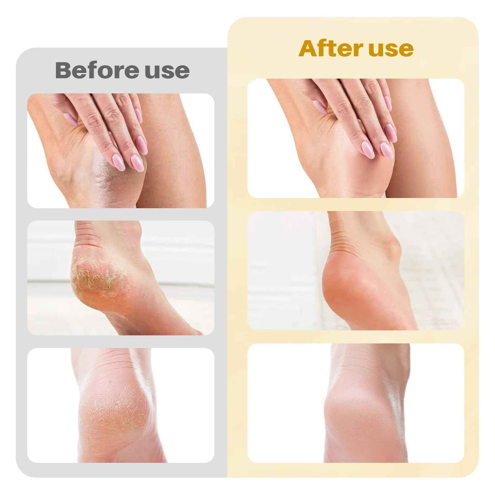 Electric Foot File and Callus Remover,Professional Pedicure Tools for Dry, Calluses, Dead, Cracked, Hard Skin,Equipped with 60 Pcs Sandpaper Discs