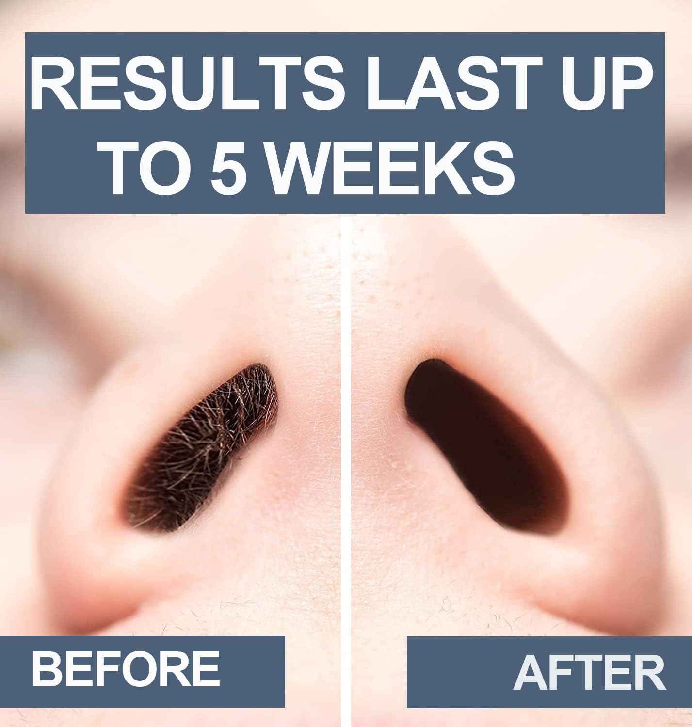 Nose Wax Kit, 120g Wax Beads, Nose Hair Wax for Men and Women, 15-20 Uses Painless Nasal & Ear Hair Removal With 40 Applicators, Wooden Sticks, Balm Wipes and Moustache Guards | Lasts up to 5 Weeks