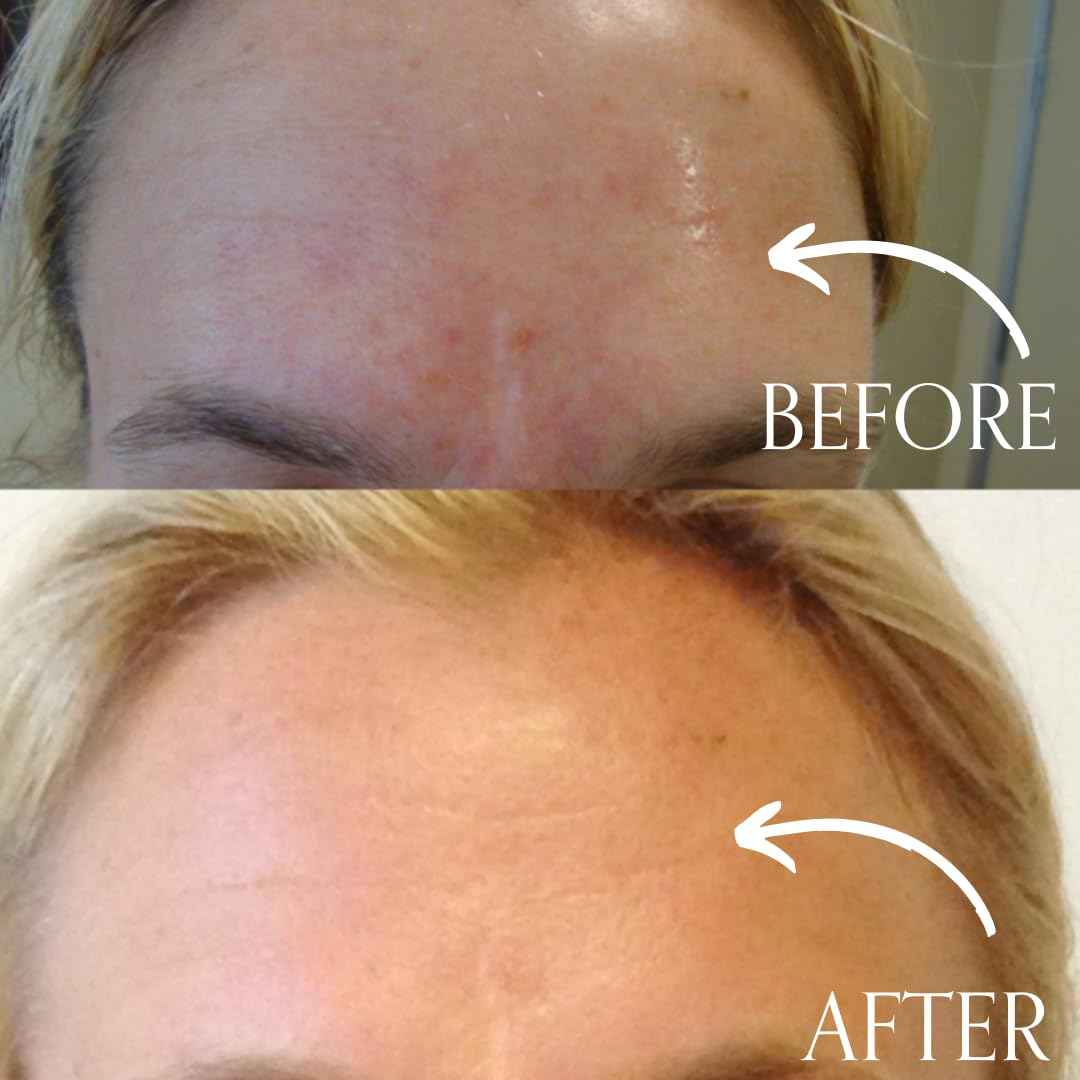 Radical Skincare Age Defying Exfoliating Pads Removes Dead Skin, Evens and Brightens Skin Tone for Radiant Glow | For All Skin Types Including Sensitive Skin | Paraben & Cruelty Free (15 Pads, 2 Pack)