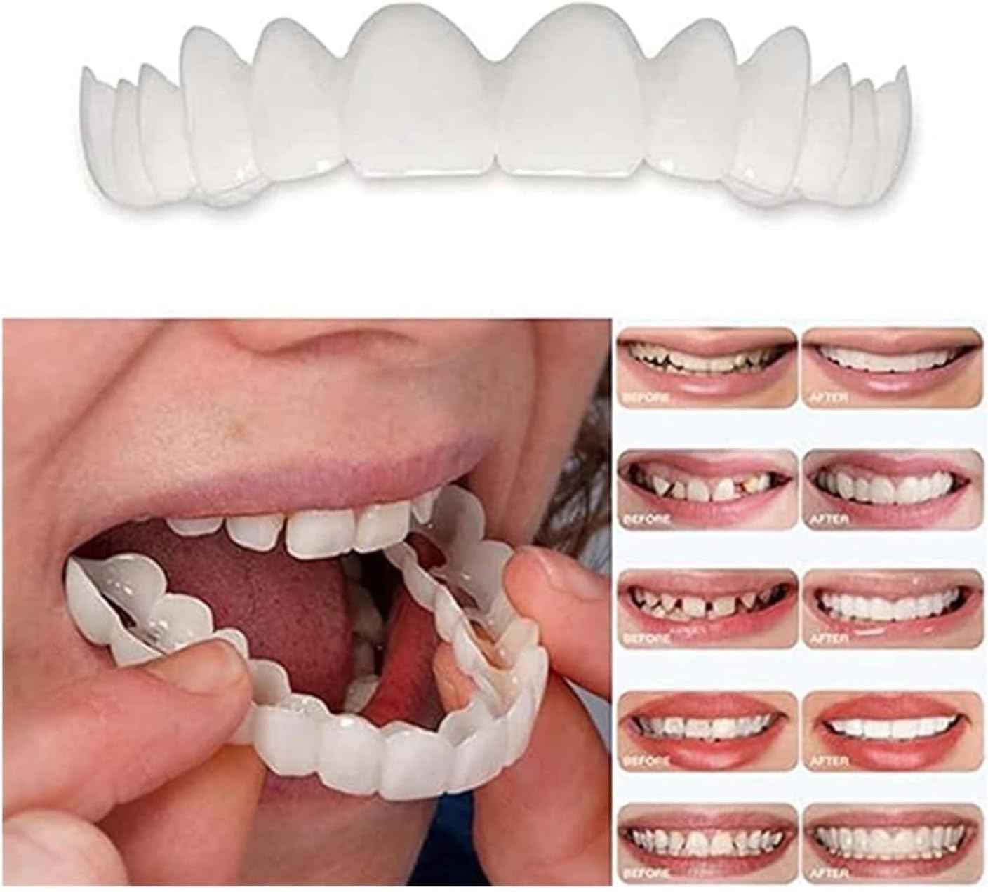 ‌2 Pairs Natural-Looking Temporary Smile Solutions, Top & Bottom Adjustable for Comfortable Experience (1.0)
