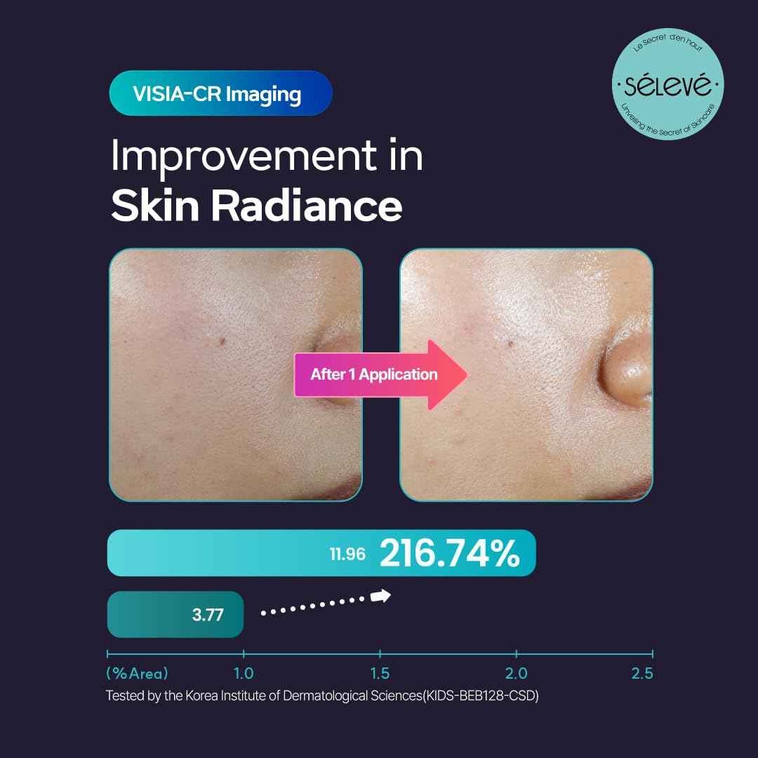 SELEVE Glow Caviar Bubble Toner – Hydrating & Glow Face Toner with Green Caviar Liposomal PDRN, Niacinamide, Panthenol & Ferulic Acid – for Sensitive & Dry Skin, Korean Skin Care (3.38 fl.oz / 100ml)