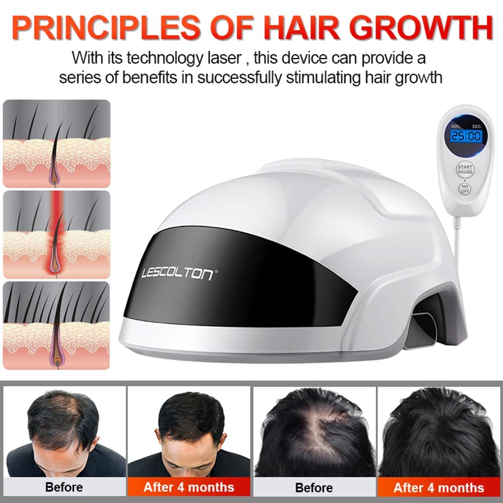 LESCOLTON Essential Hair Growth System, FDA Cleared, Hair Regrowth Laser Cap Treatment Device For Men & Women Thinning Hair, Red Light Therapy