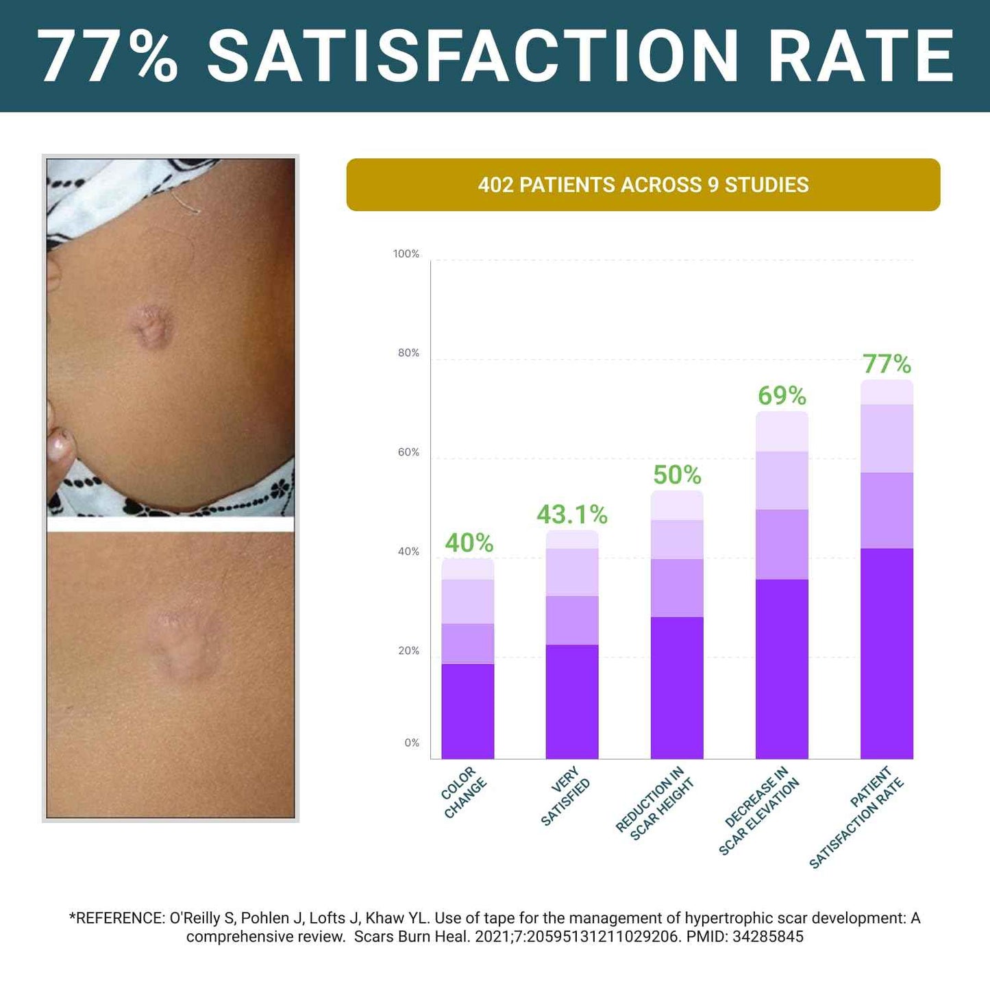 Silicone Scar Sheets, Silicone Scar Tape For Surgical Scars - Clinically Validated Technology Scar Removal Strips For Surgical, C-Section, Tummy Tuck, Keloid Scars - Reusable, Waterproof - Pack of 3