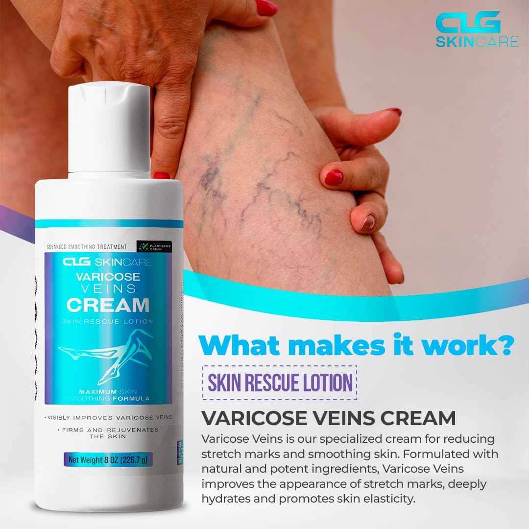 CLG Skincare Varicose Veins Cream - Skin Rescue Lotion for Smoother, Healthier Legs - Advanced Formula for Varicose Veins Improvement, Circulation & Skin Firming, Plant-Based Ingredients, 8 oz (1)