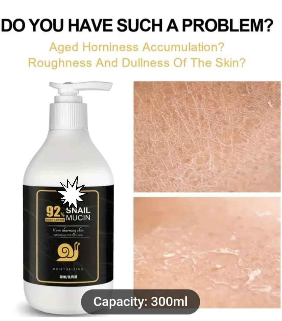 Generic Snail Mucin 92% Nourishing Body Cream Body Milk With Vitamin C, Moisturizing, Firming Skin, Refreshing, Non Greasy, Easy To Absorb, Suitable For All Skin Types (10.1 oz Body Cream)