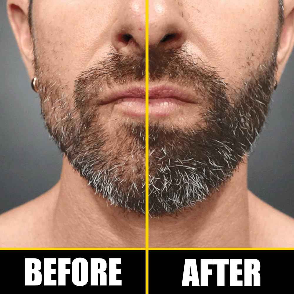 Pete & Pedro BOOST Hair & Beard Strengthening & Growth Natural Scalp Health Serum Oil For Men & Women - With Rosemary, Biotin & 20 plus Essential Oils | Shark Tank Featured, 2 oz.