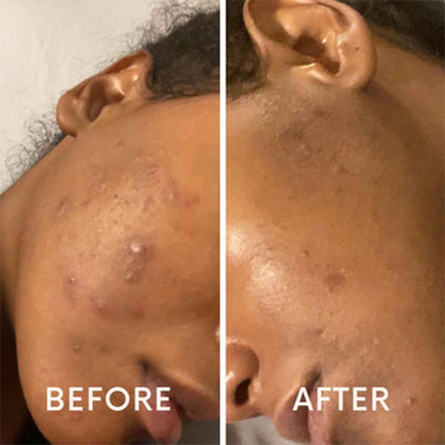 Hydrating Face Moisturizer with Hyaluronic Acid and Aloe – Lightweight Daily Facial Cream for Dry, Oily, Combination, Mature & Sensitive Skin – Nourishing, Non-Greasy, Fast-Absorbing – 2 oz