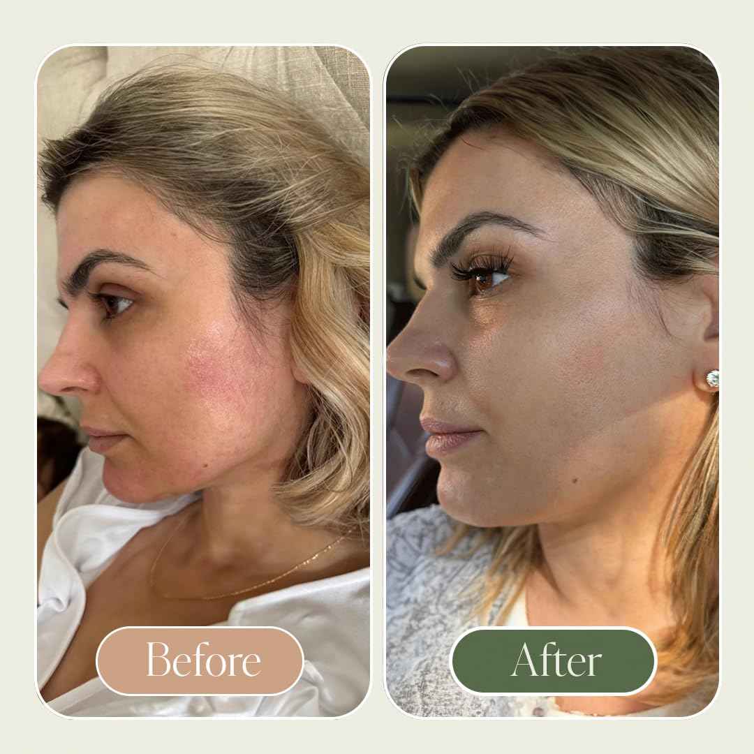 KUSHI Grass-Fed Whipped Tallow Cream Moisturizer for Face & Body – Organic Lavender – Vitamins A, D, E, K – Paraben & Sulfate Free, All-Natural Skin Care – 1.3oz