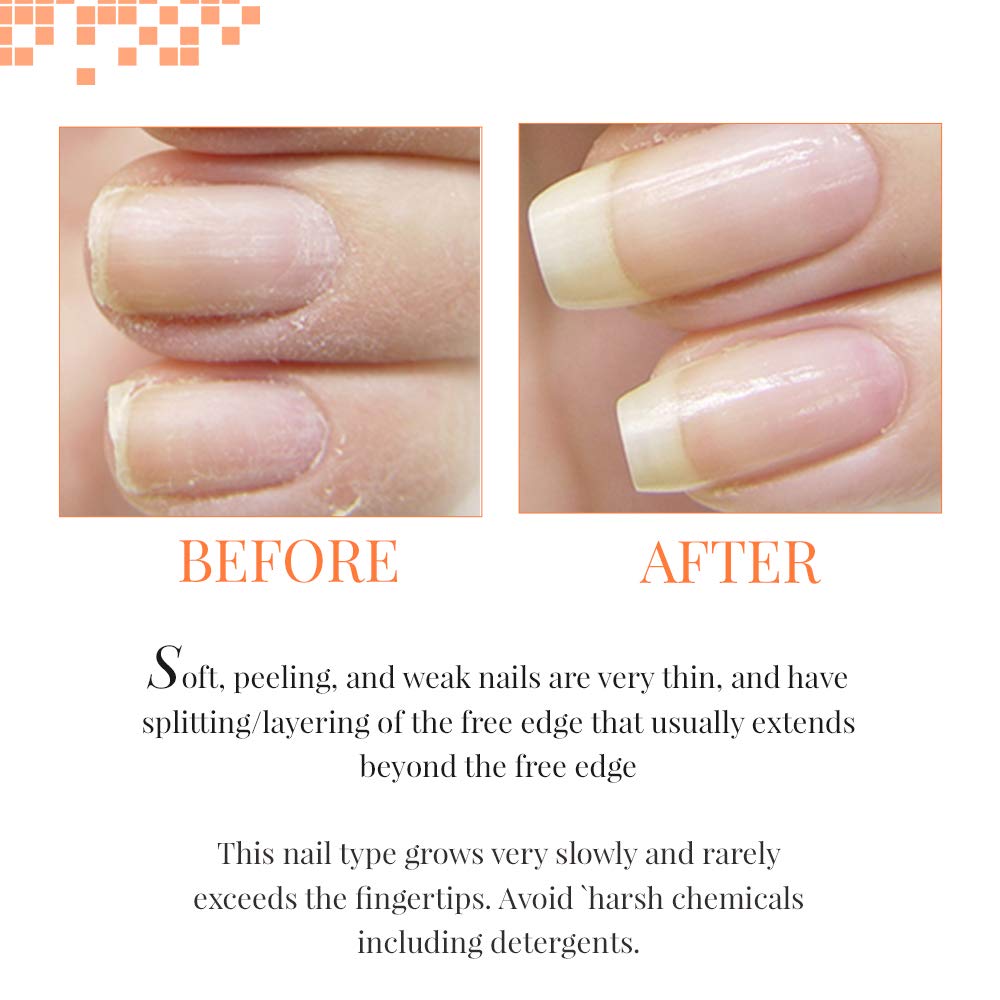 Nail Tek Treatments Intensive Therapy 2 | Nail Strengthener for Soft and Peeling Nails | Professional Refill | 4 Fl. Oz.