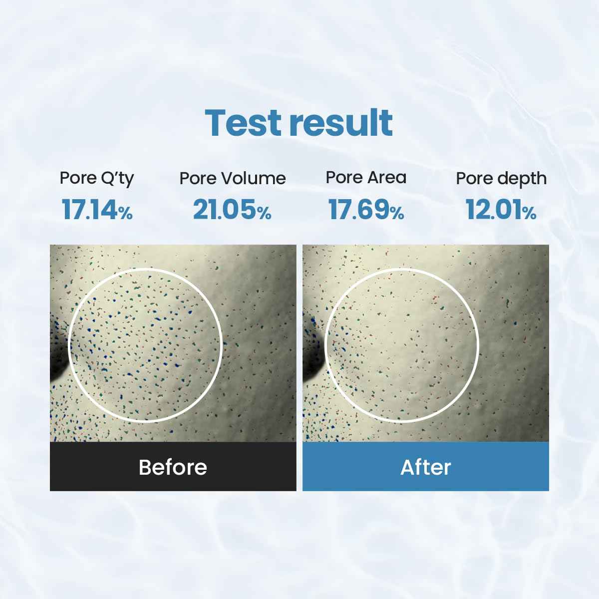 res novae Peeling Toner Pad – 60 Pads – Blackhead & Whitehead Removal, Pore Minimizing, Oil Control, Gentle PHA Exfoliation for Sensitive Skin