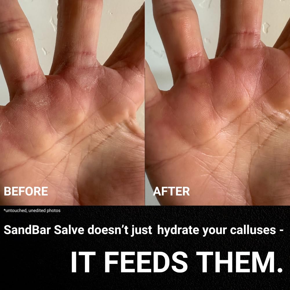 SandBar Natural Callus Salve - Revitalizing Callus Balm - Heal, Nourish & Maintain Your Calluses - On The Go Callus Repair & Care - Convenient Essential - Immediate Relief For Callus Tears