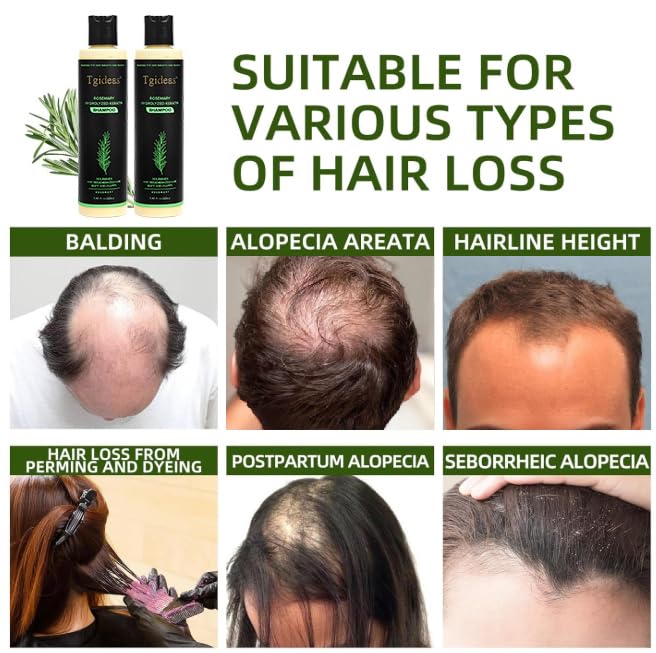Tgideas Organic Rosemary Hair Growth Shampoo for Thinning Hair