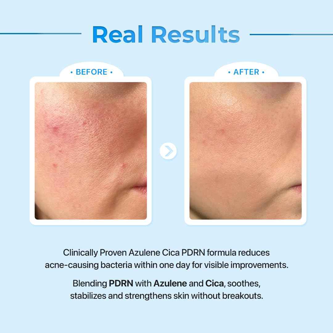 Le Nubele Azulene Cica Hyaluronic PDRN Capsule Standard Ampoule 02, Salmon DNA PDRN 3,000ppm, Peptide, Collagen Booster, Skin Rejuvenation, Hydrating, Acne Skin, Korean Skin Care 30ml/1.01 fl.oz.