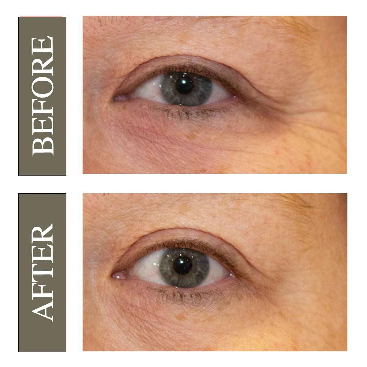 Hey Honey Open Your Eyes Lifting Eye Serum | Under Eye Cream for Dark Circles & Puffiness | Around The Eyes Hydration | Suitable For Sensitive Aging Skin | Delivers A Bright Rested look | 0.5 oz.