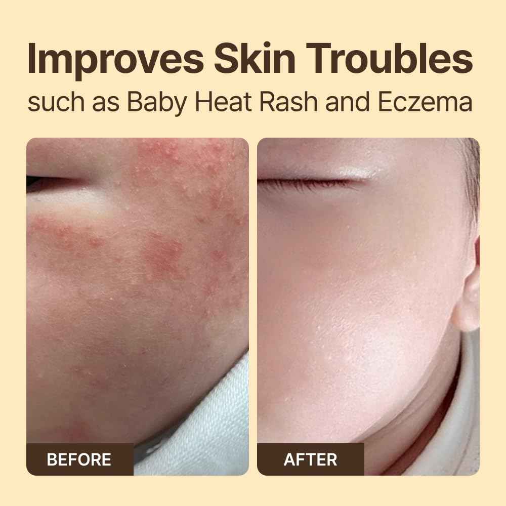 ruuve Ceramide Intense Moisture Cream – Deep Hydration Cream, Fragrance Free, Non-Greasy, Improves Moisture up to 2.5mm in One Use, Dermatologically Tested, Korean Skin care, 5.07 Fl oz