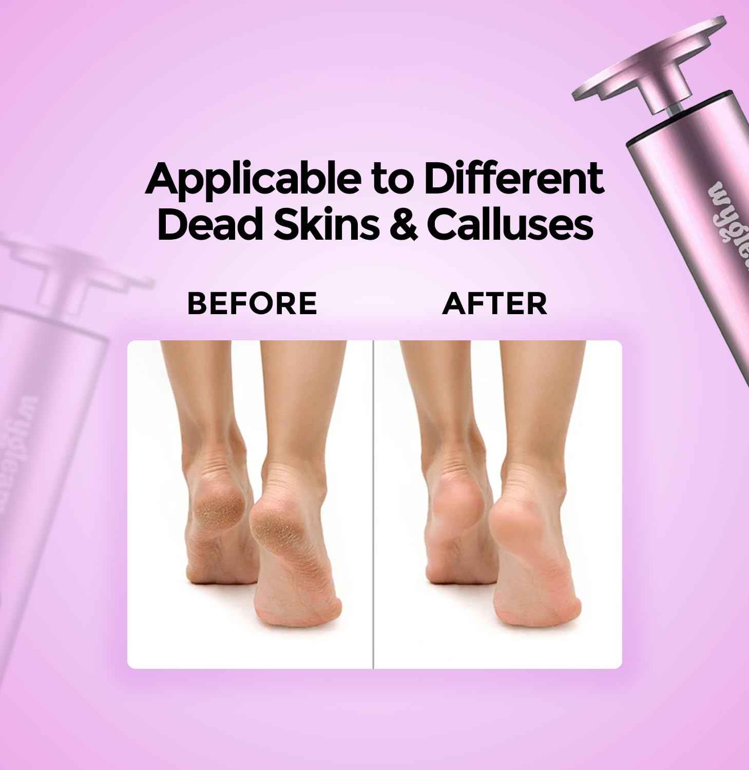 Wygleam Electric Callus Remover for Feet & Nail File Drill Kit - 2 in 1 Rechargeable Pedicure Tools for Flawless Feet - Professional Foot File with 3 Speeds for Dead Skin Removal - at Home Pedicure