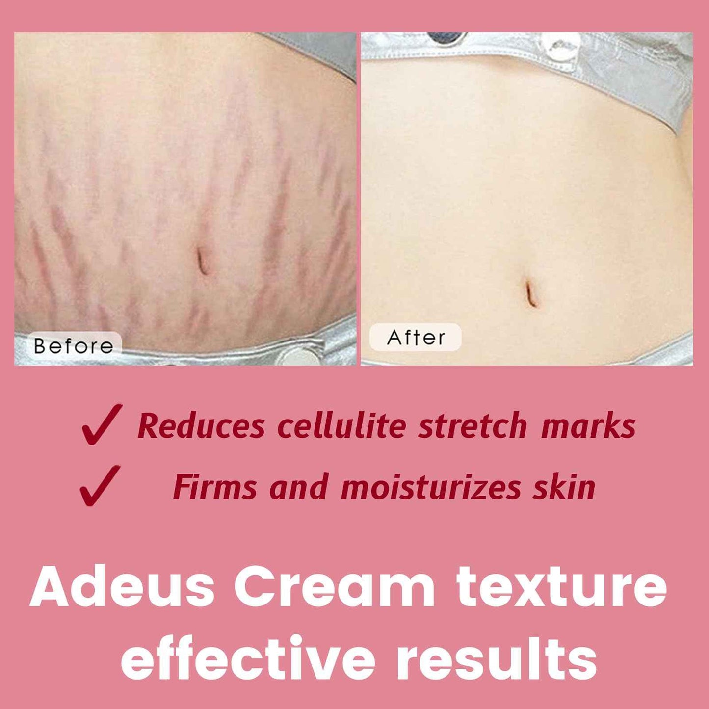 ADEUS Crema Brasileña, Multifunctional Pink Intensive Cream, Cream Rose Body Intensive Skin with Asiatica & Seaweed Extract Moisturizing & Smoothing Skincare (1)