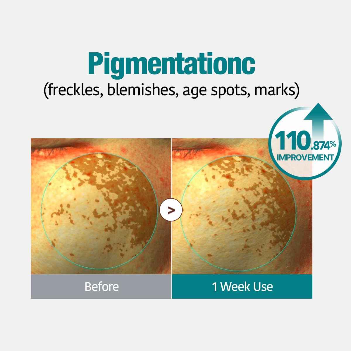 GOODAL Green Tangerine Vita C Gel Mask, Deep Moisturizing Hydrogel Essence, Vitamin C Face Mask for Glass & Glow Skin, Overnight Facial Mask, Jelly Mask for Sensitive Skin, Korean Skin Care, 5EA