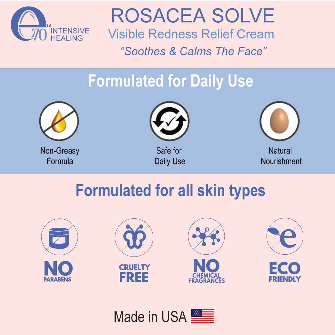 e70 Rosacea Solve - Redness Relief Cream - Face Moisturizer For Rosacea & Acne Prone Skin - Skin Care With Organic Ingredients, Almond Oil, Licorice and Chamomile Extracts - No Parabens (Pack of 2)