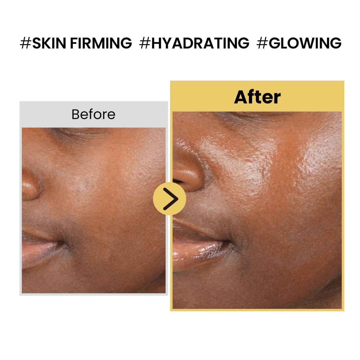 coxir INTENSIVE EGF PEPTIDES CREAM l Day&Night Firming Cream l EGF(Epidermal Growth Factor), Peptides, Niacinamide, Panthenol, Collagen l Korean Skincare [50ml/1.69fl.oz] (Pack of 2)