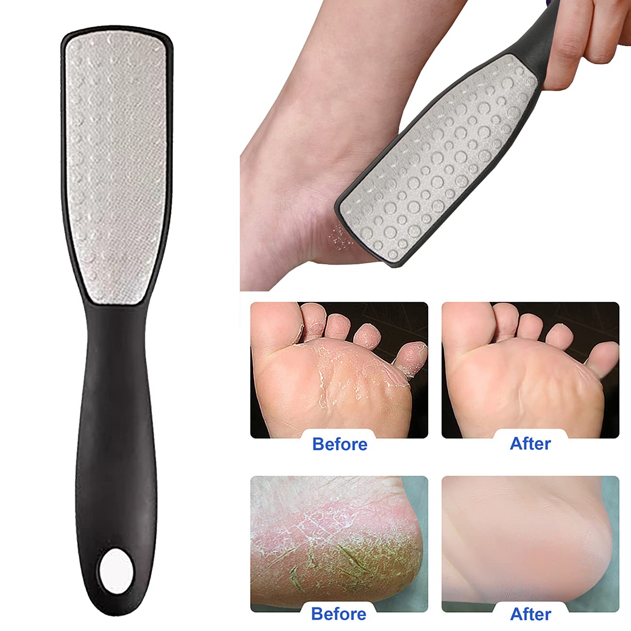 Fanzbike Foot Rasp Foot Files Callus Remover - Professional Foot Care Pedicure Stainless Steel File to Removes Hard Skin (Double-Sided flattop)