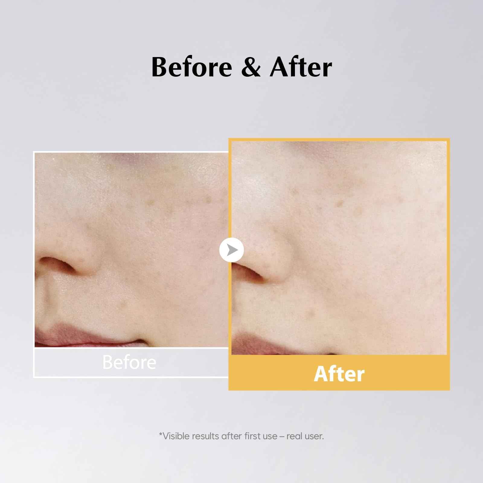 MIDHA RICE MASK, 3.38fl.oz/100ml, Hydrating, Smoothing, for Dull, Rough Skin, Pore Clearing, Wash off Pack Facial Mask, Mud Texture, Uneven Skin Tone