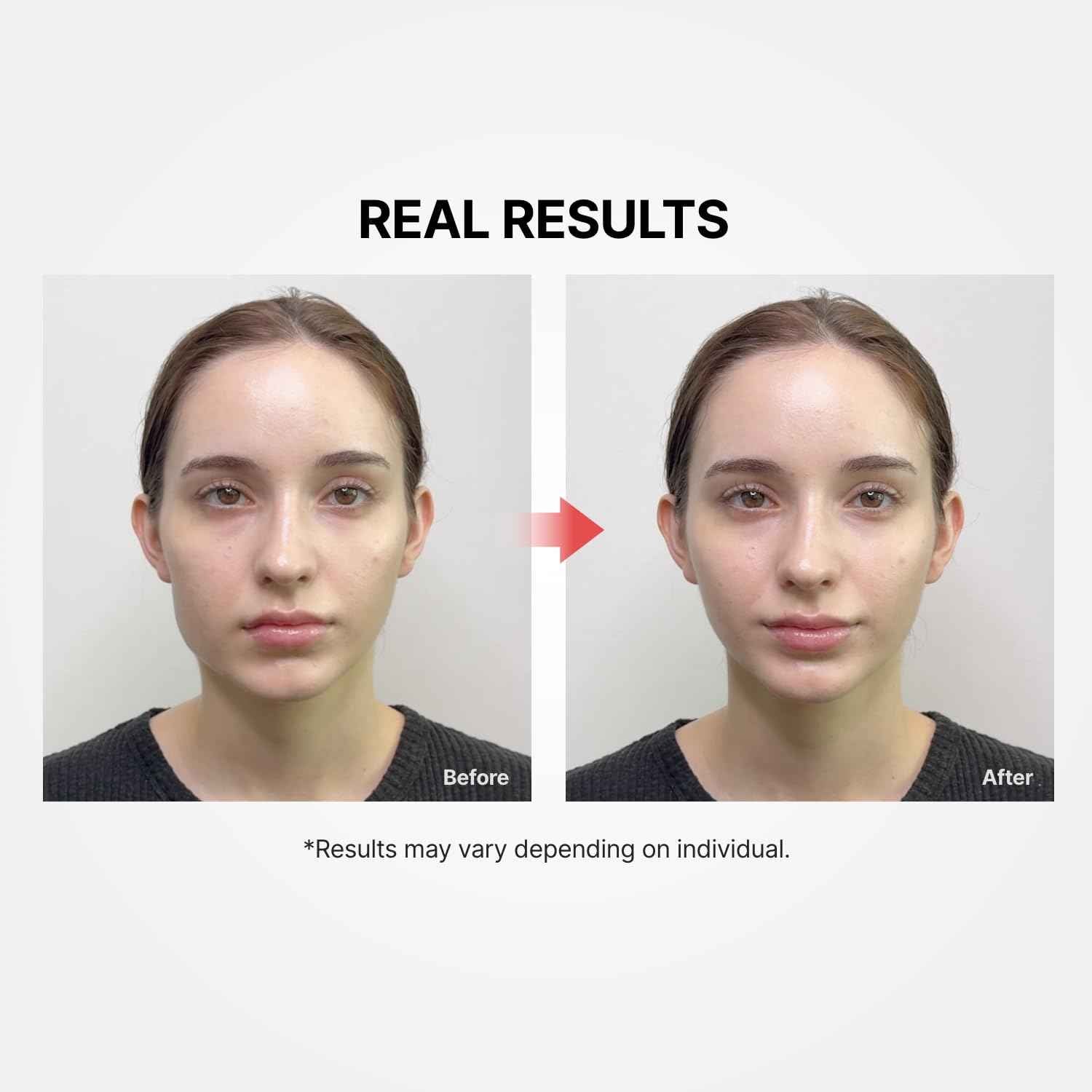 Shumage Gold Seal Lifting Cream+Device - Moisturizer Face Lift Cream, Hydrating & Tightening for Sagging Skin - Korean Face Moisturizer - Microcurrent Facial Device for Radiant Glow Skin - 1.69 Fl. Oz