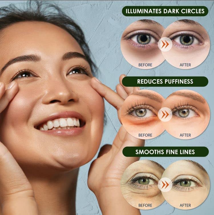 Purederm Cica Calming Under Eye Mask (4 Pack) – Cica Under Eye Patches for Relaxing & Calming