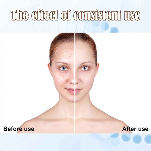 BB Facial Glow Starter Kit Serum Hyaluronic Acid Essence Skin Care Set, Salmon DNA Glod Ampoule 0.27oz 12 Vials, Glow Repair Kit with 7 Different Peptides