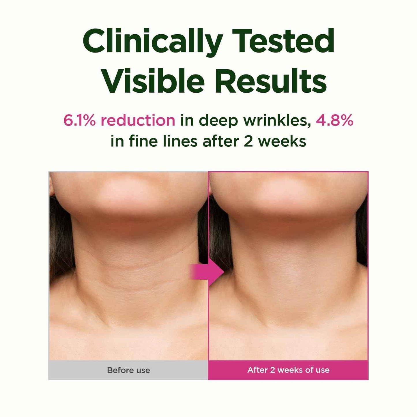 CKD Retino Collagen Gua Sha Neck Cream - Firming Cream for Neck and Jawline Tightening, Lifting, and Wrinkle Reduction with Stainless Steel Roller. Korean Skin Care,1.69 fl oz.