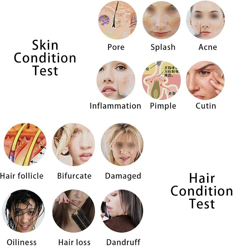 Digital Skin Hair Analyzer with 5" Screen & 50X/200X Lens