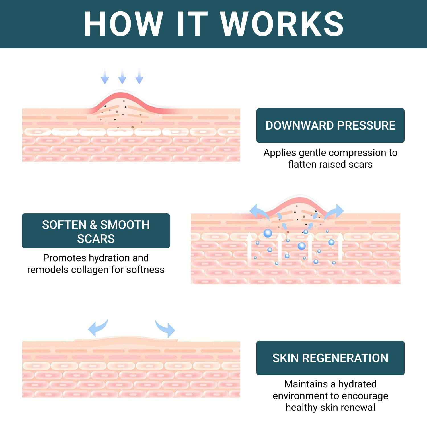 Silicone Scar Sheets, Silicone Scar Tape For Surgical Scars - Clinically Validated Technology Scar Removal Strips For Surgical, C-Section, Tummy Tuck, Keloid Scars - Reusable, Waterproof - Pack of 3