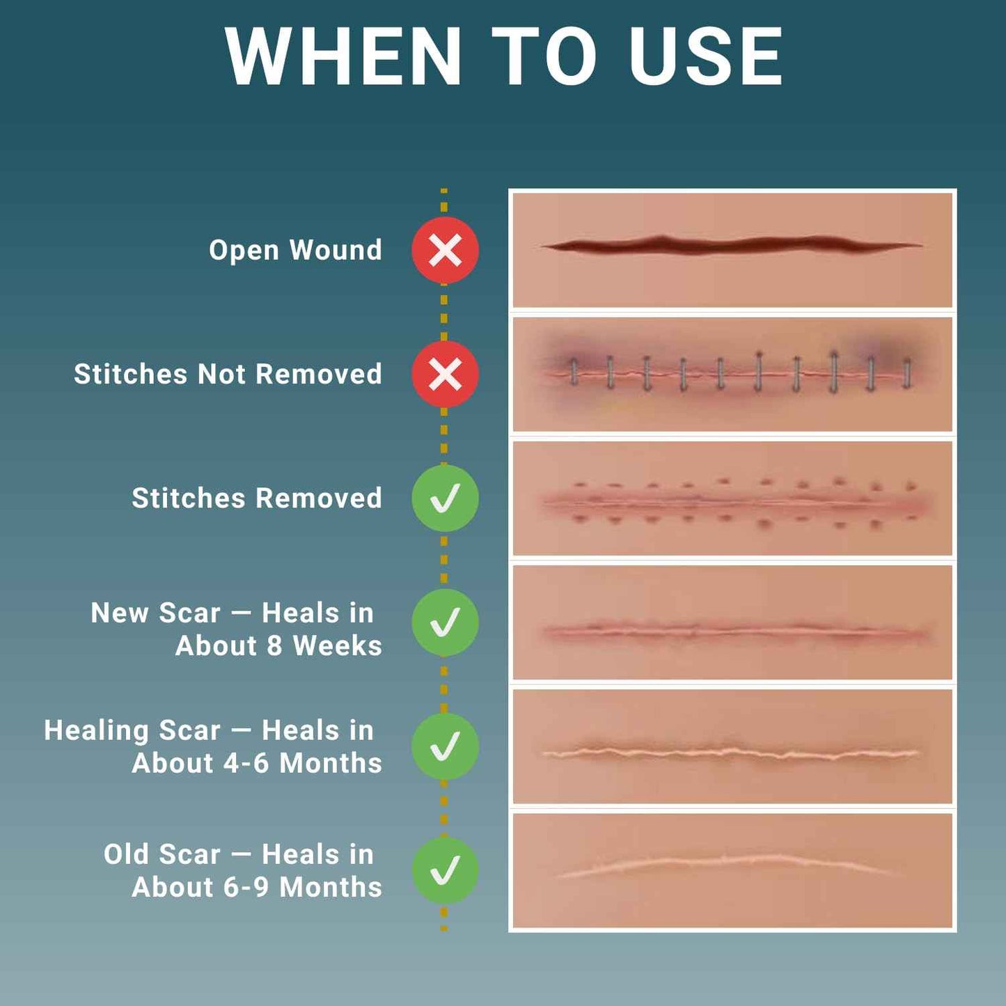 Silicone Scar Sheets, Silicone Scar Tape For Surgical Scars - Clinically Validated Technology Scar Removal Strips For Surgical, C-Section, Tummy Tuck, Keloid Scars - Reusable, Waterproof - Pack of 3