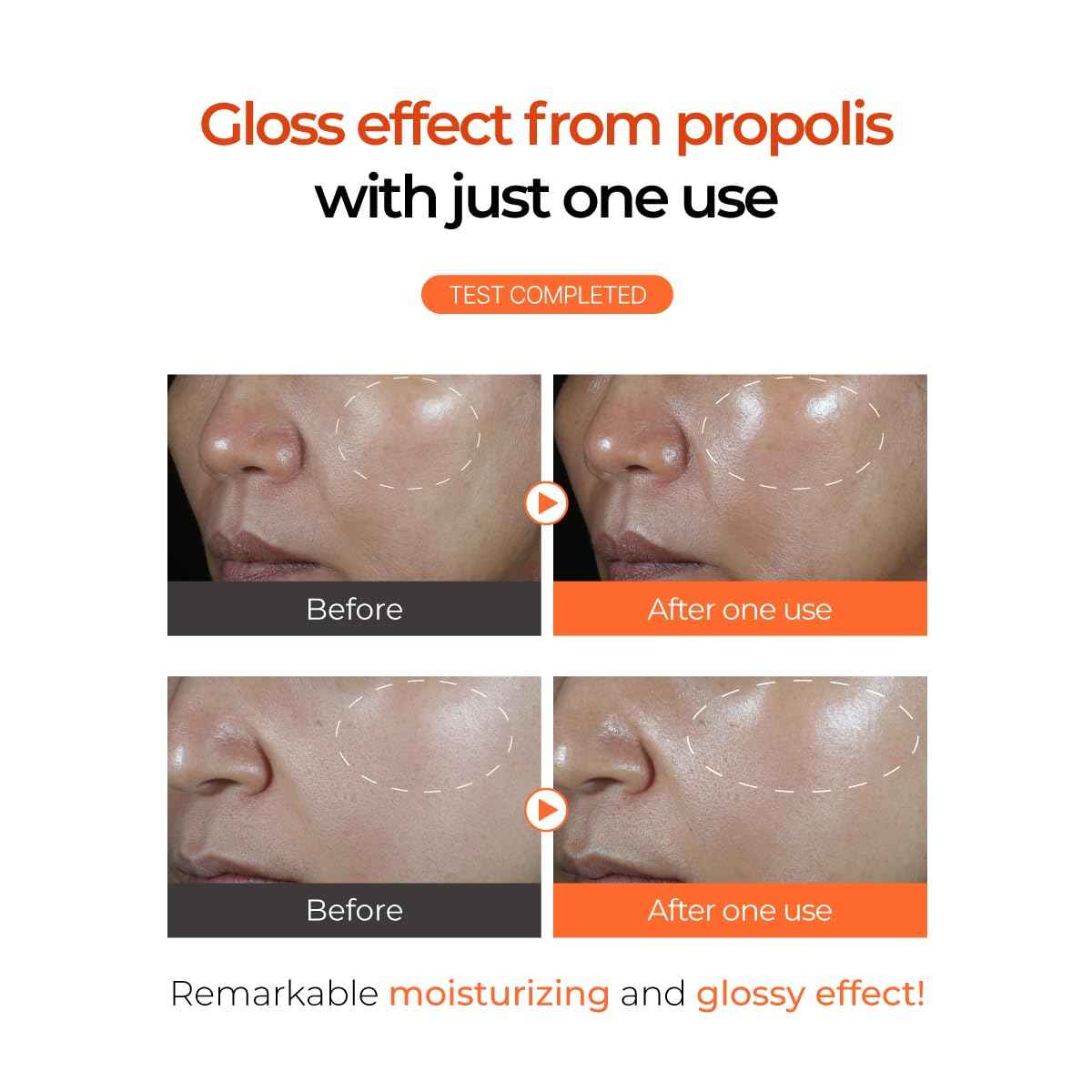 IZEZE PROPOLIS PBA Enrich Serum 1.01 fl.oz, 30 ml | Rich Nourishment for Glow Skin, Deep Hydration, Korean Skincare Niacinamide Serum, Skin Elasticity