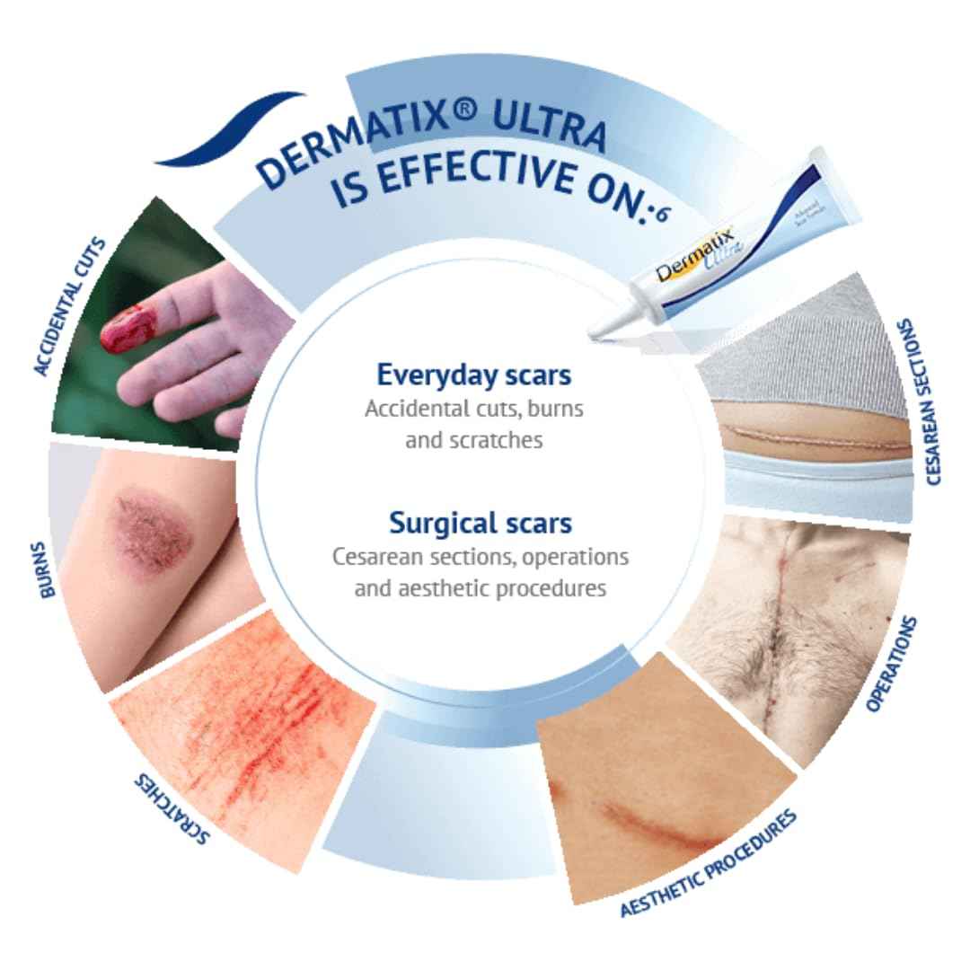 Dermatix Ultra Advanced Scar Gel - 15g, Softens and Flattens Scars, Quick-Drying and Odorless Formula