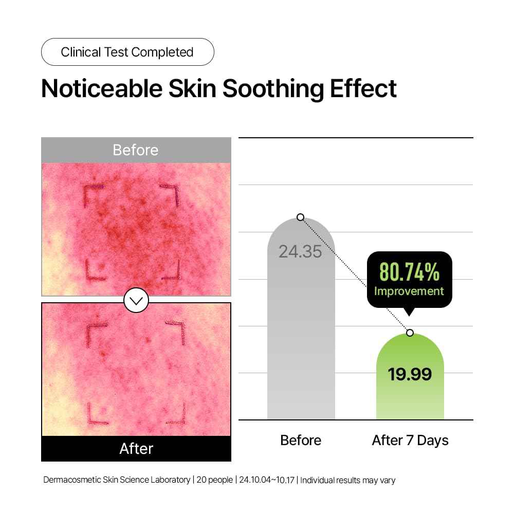 Parnell Panthenol 3.89% | 50ml / 1.69 fl.oz. | Heartleaf Calming Capsule Cream, Acne soothing cream, korea skin care, korea beauty