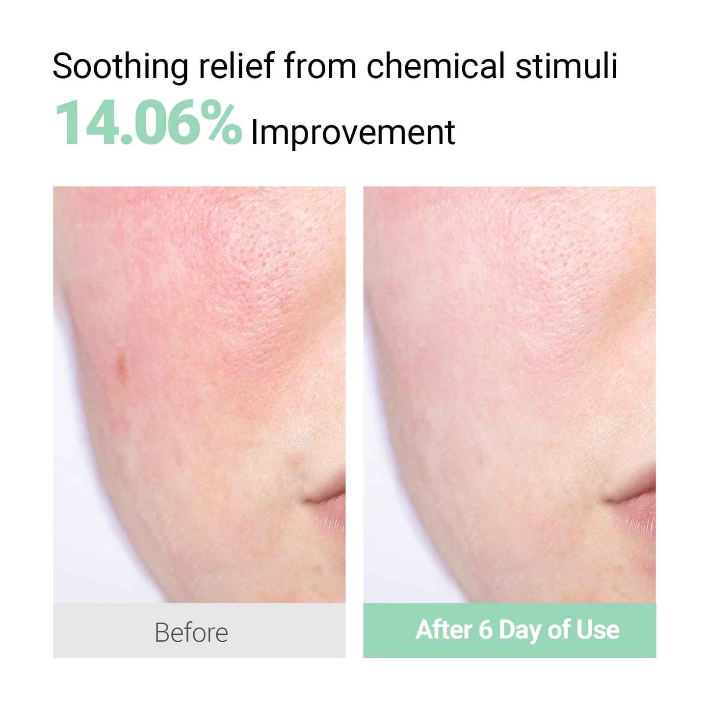 NEAF NEAF Smoothing Calm Cream with Panthenol, Hyaluronic Acid for Sensitive Skin, Lightweight, Korean Skincare (50ml/ 1.76 oz.) Nourishing Skin Barrier Moisturizer