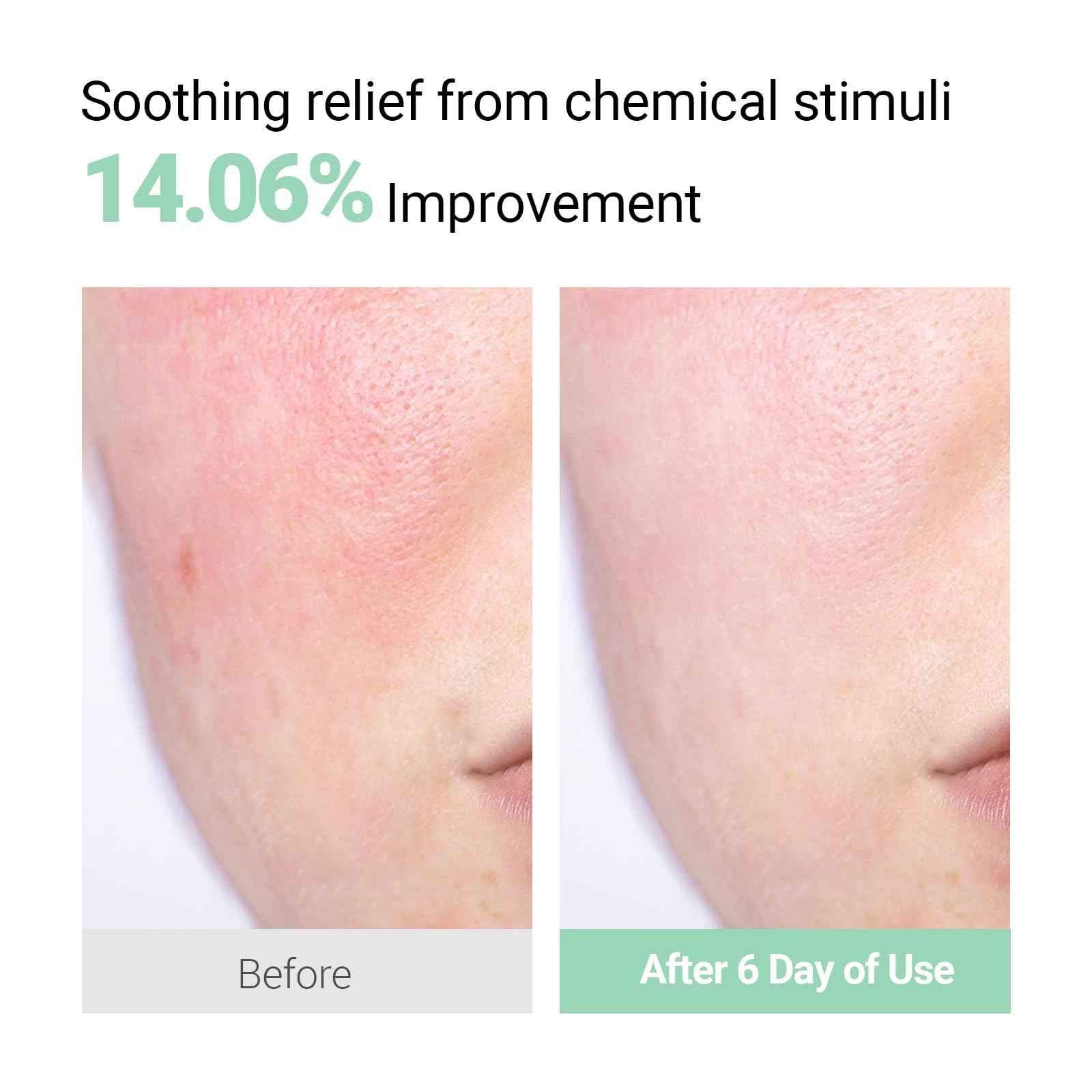 NEAF NEAF Smoothing Calm Cream with Panthenol, Hyaluronic Acid for Sensitive Skin, Lightweight, Korean Skincare (50ml/ 1.76 oz.) Nourishing Skin Barrier Moisturizer