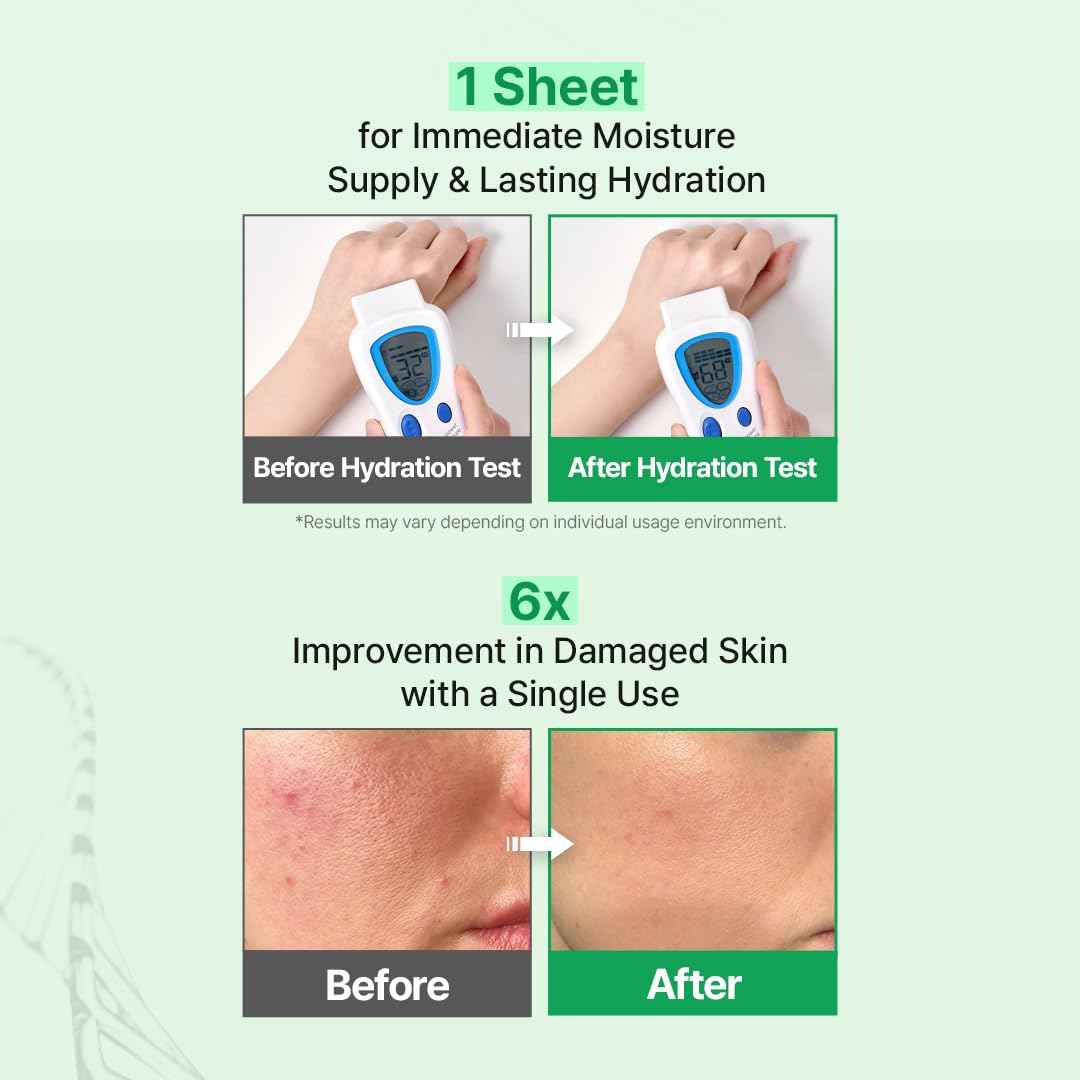 Zipiderm EGF Skin Barrier Dressing Sheet Mask – Korean Soothing & Hydrating Facial Mask with Ceramide & Panthenol for Sensitive, Dry & Acne-Prone Skin, Vegan K-Beauty Skincare Sheet, 4EA