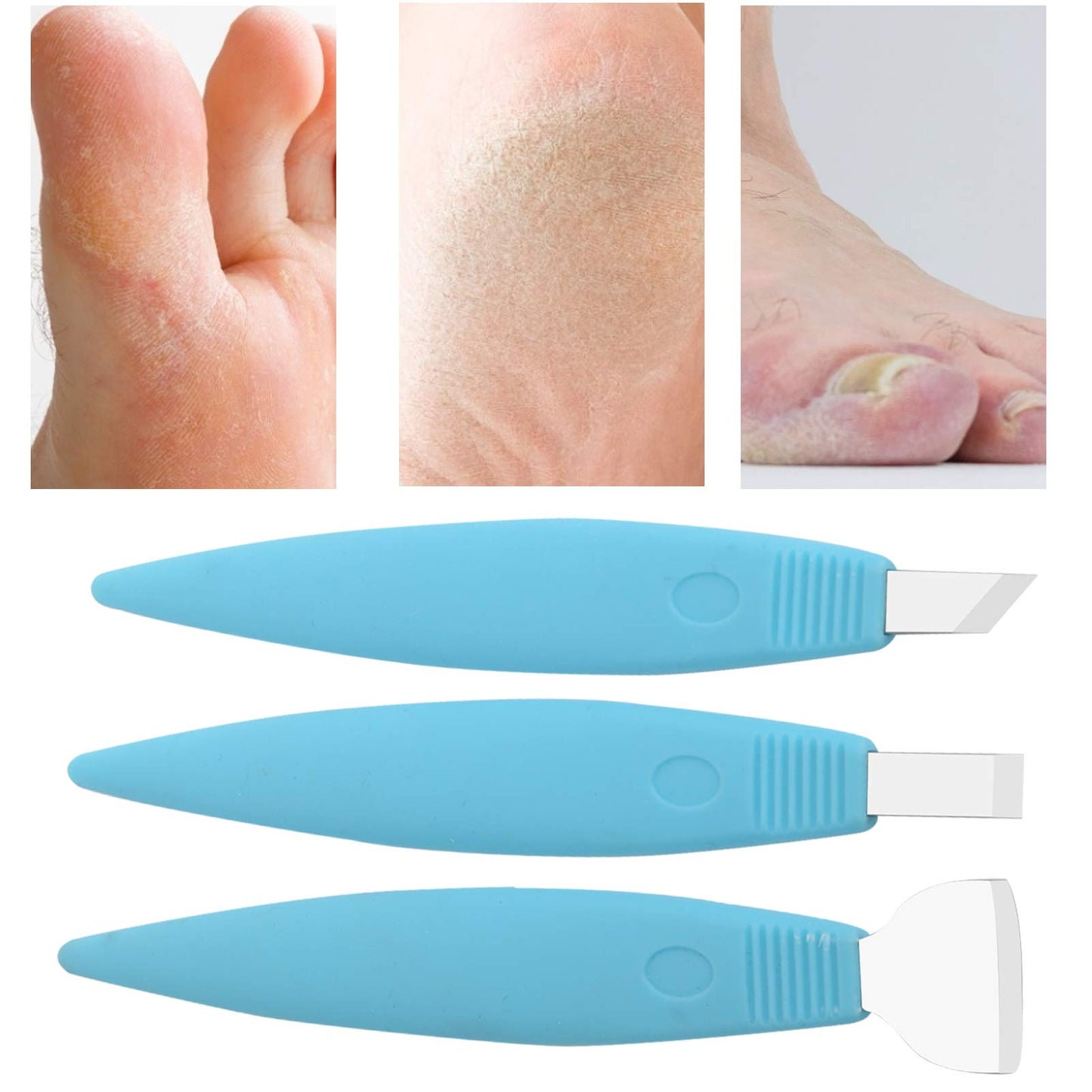 Pedicure Knife Set for Feet, 3Pcs Stainless Steel Pedicure Knife Tools Ingrown Toe Nail Foot Callus Dead Skin Remover Nail for Feet Grooming Nail Care Tools Kit for Nail Corn Callus(Blue)