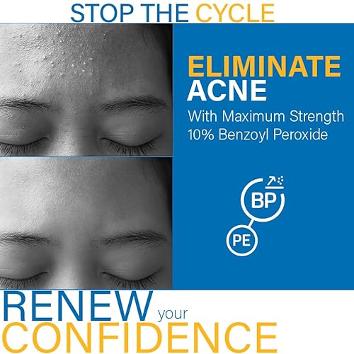 DCL Skincare B Prox Acne Treatment Cleanser with 10% Benzoyl Peroxide, Maximum Strength Acne Wash for Breakouts, Oil Control & Clear Skin, 6.7 fl oz
